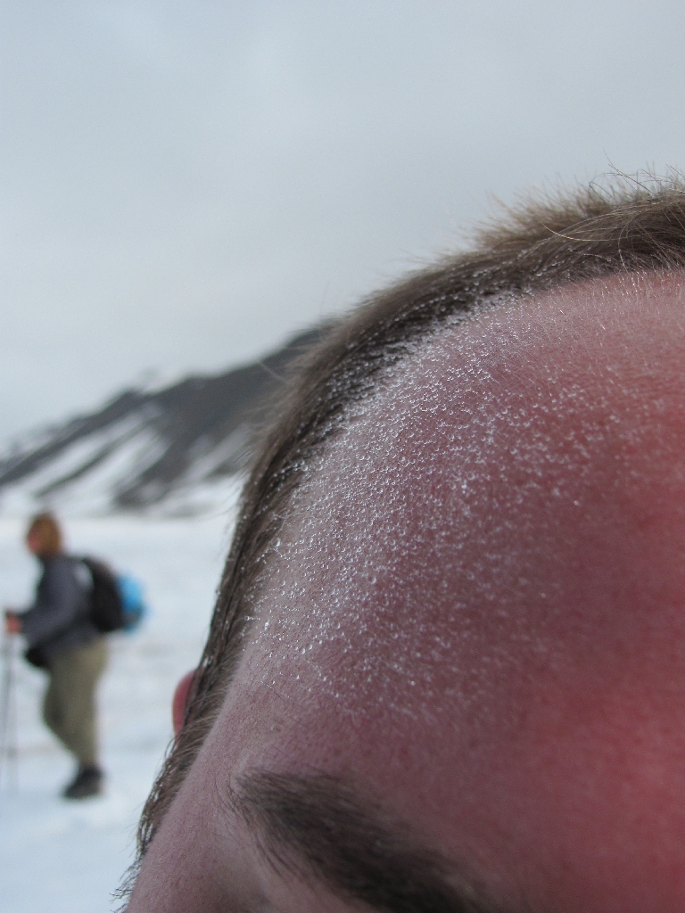 Bizarre Eisformen auf Stefans Stirn