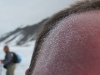 Bizarre Eisformen auf Stefans Stirn